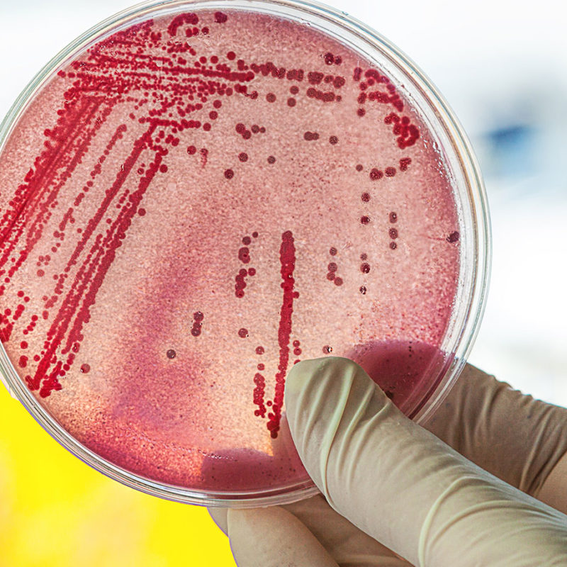 E-coli-Bakterien - das machen sie im Darm. Foto Petrischale